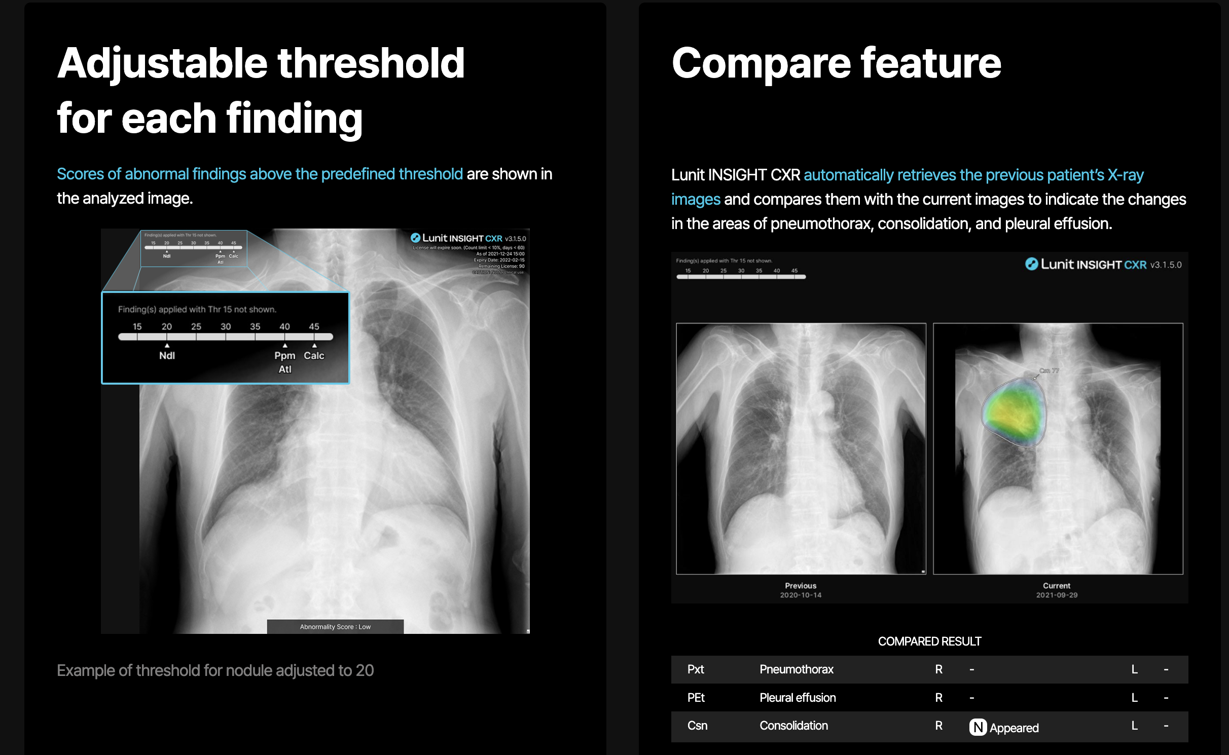 Lunit's computer-aided detection / diagnosis software